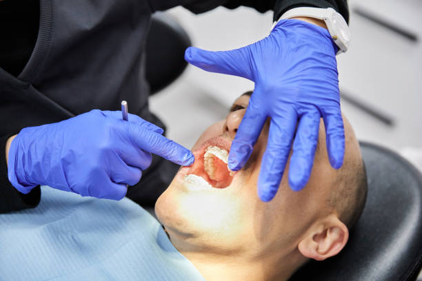 Fast & Reliable Emergency Dental Services in CA